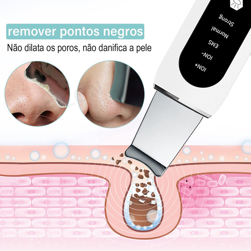 esfoliante ultrassonico para limpeza de pele e remoção de cravos limpeza facial profunda.