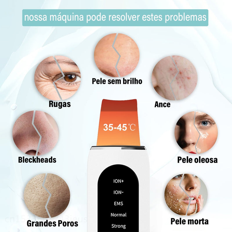 esfoliante ultrassonico para limpeza de pele e remoção de cravos limpeza facial profunda.